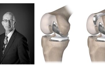 Spire Hospital Southampton offer more options for knee surgery